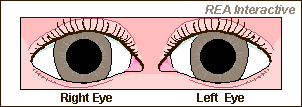 hippus pupil