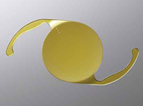 Lens Implants | Richmond VA | Glen Allen VA